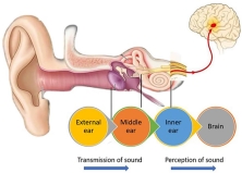 NGHE KÉM Ở TRẺ EM: NHẬN THỨC SỚM – CAN THIỆP KỊP THỜI