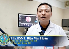 PHẪU THUẬT NỘI SOI MŨI XOANG LẤY DỊ VẬT VIÊN BI SẮT CHO BỆNH NHI 6 TUỔI PHẪU THUẬT NỘI SOI MŨI XOANG LẤY DỊ VẬT VIÊN BI SẮT CHO BỆNH NHI 6 TUỔI