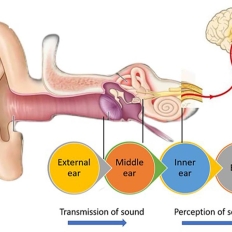NGHE KÉM Ở TRẺ EM: NHẬN THỨC SỚM – CAN THIỆP KỊP THỜI